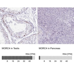 MORC4 Antibody, Novus Biologicals:Antibodies:Primary Antibodies